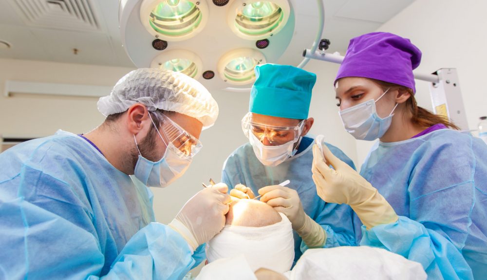 Baldness treatment. Hair transplant. Surgeons in the operating room carry out hair transplant surgery. Surgical technique that moves hair follicles from a part of the head