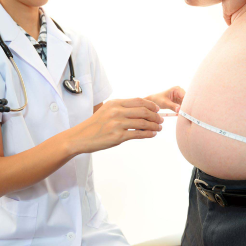 General surgery Obesity and Bariatric Surgery
