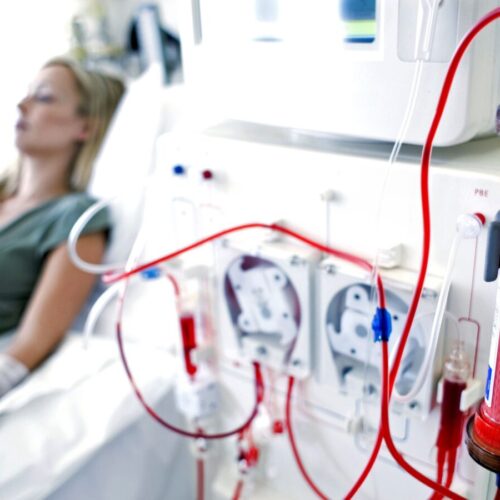 Renal Dialysis